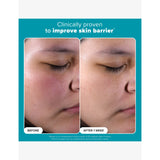 Paula's Choice 2% BHA exfoliating toner 30ml (British brand)