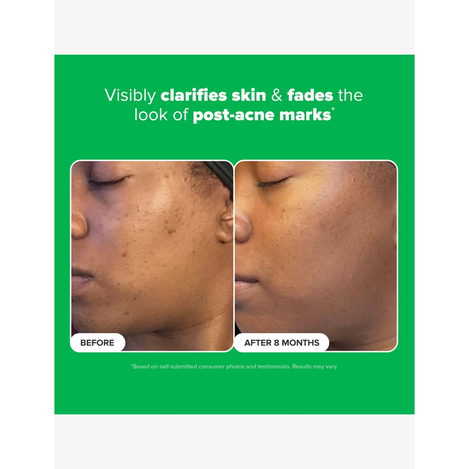 Paula's Choice 10% Azelaic Acid Booster 30ml, UK version
