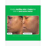 Paula's Choice 10% Azelaic Acid Booster 30ml, UK version