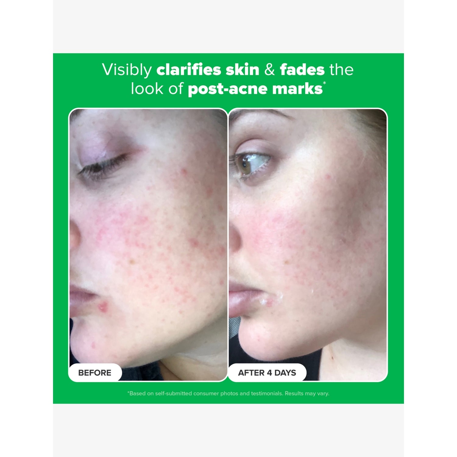 Paula's Choice 10% Azelaic Acid Booster 30ml, UK version