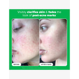 Paula's Choice 10% Azelaic Acid Booster 30ml, UK version