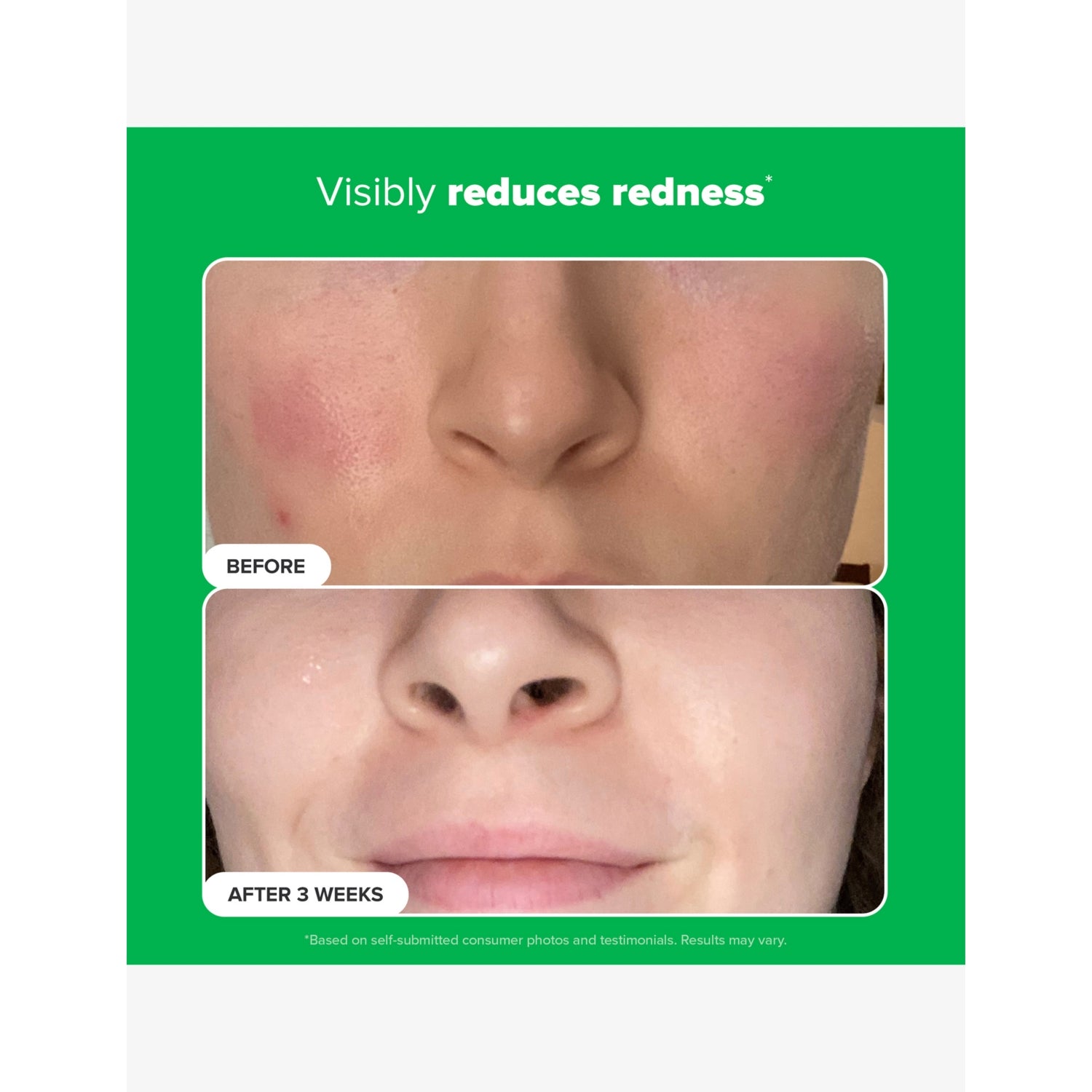 Paula's Choice 10% Azelaic Acid Booster 30ml, UK version