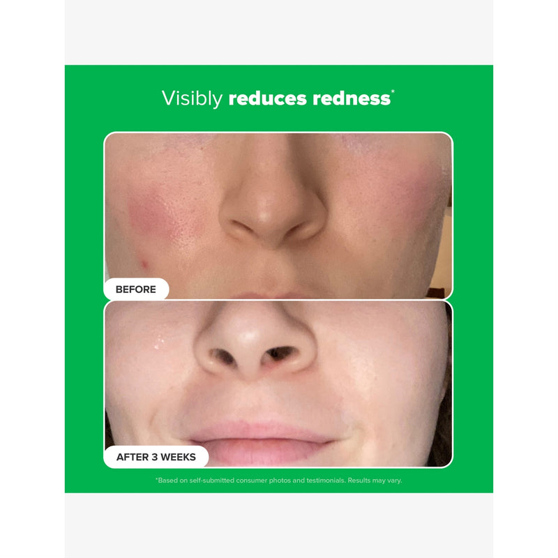 Paula's Choice 10% Azelaic Acid Booster 30ml, UK version