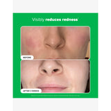 Paula's Choice 10% Azelaic Acid Booster 30ml, UK version