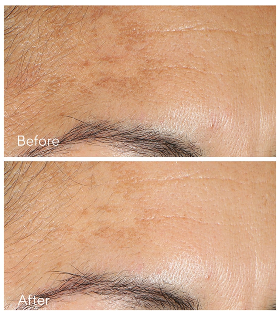 Murad Vita C Glycolic Serum 30ml, imported from the UK