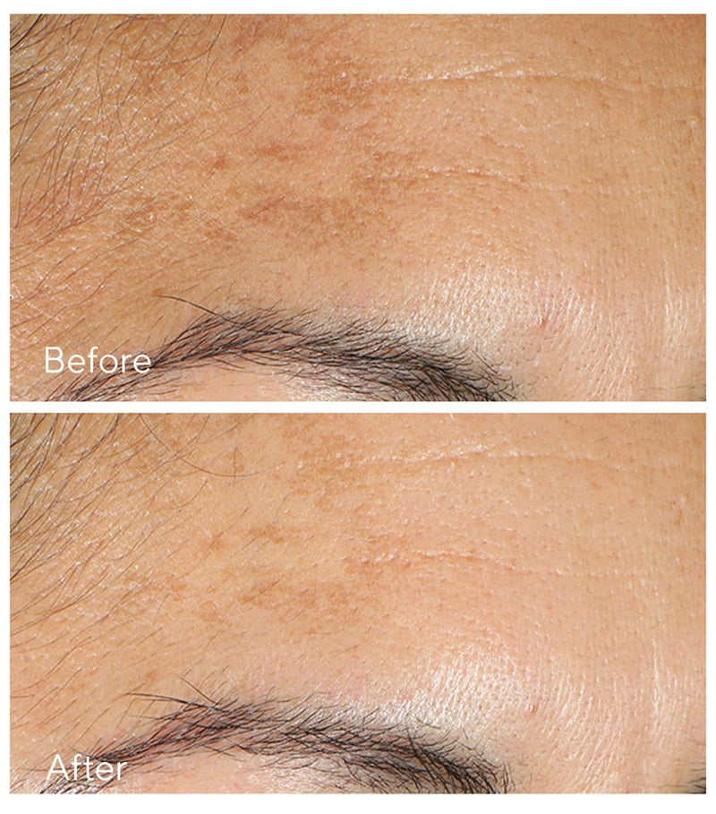 Murad Vita C Glycolic Serum 30ml, imported from the UK