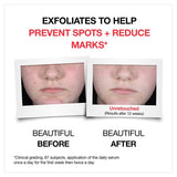 Neutrogena Clear and Defend Serum 10 with AHAPHA  Salicylic Acid