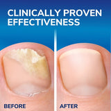 Scholl Fungal Nail 2 in 1 Treat & Shield 3.8mL - British product