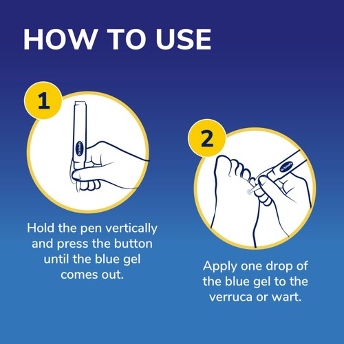 Scholl Wart & Verruca Removal Pen (British brand)