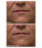 Dr Dennis Gross gentle peel sensitive skin 5 treatments - British product