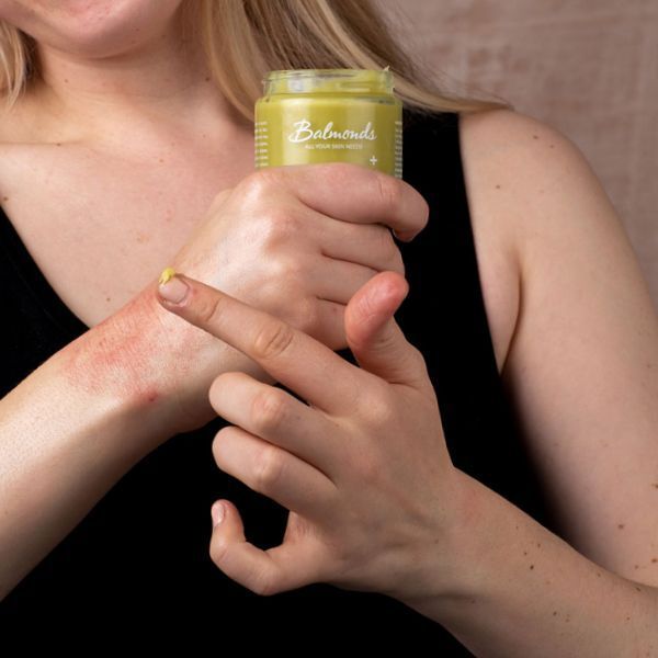 Balmonds Skin Salvation balm 30ml, imported from the UK