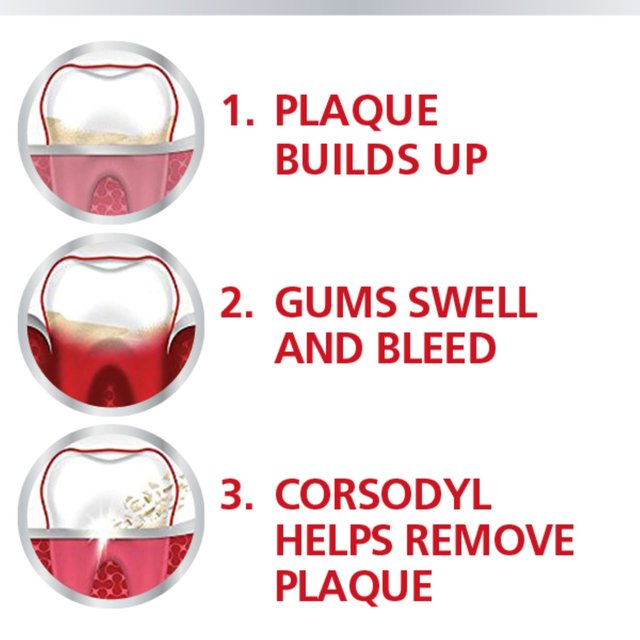 Corsodyl Gum Mouthwash Original Alcohol Free Antibacterial   300ml GOODS M&S   