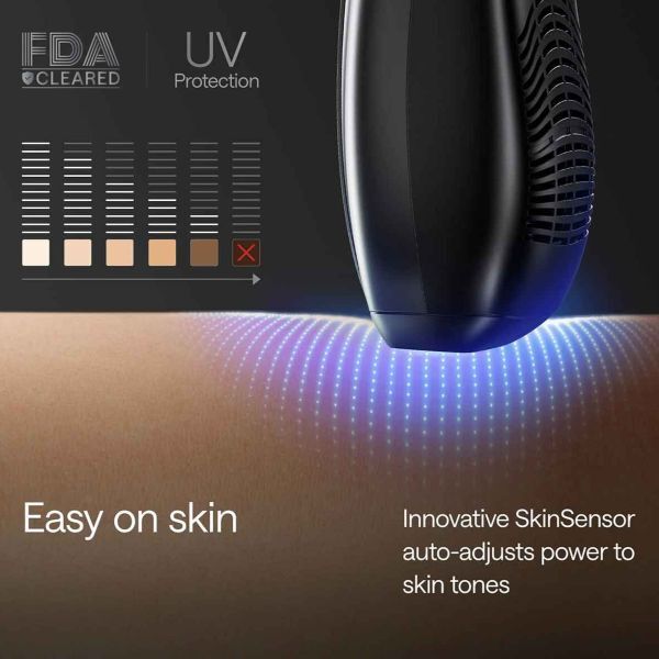 Ulike X IPL hair removal device black (British brand)