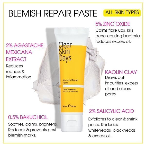 Clear Skin Days Overnight Blemish Repair Paste 30ml GOODS Superdrug   