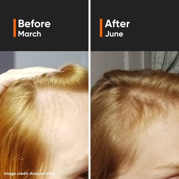 Minimalist hair density serum for growth, imported from the UK