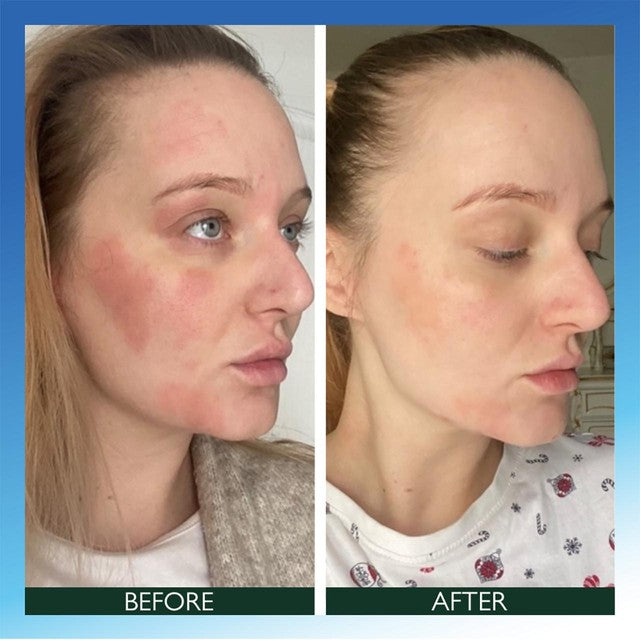 Sorted Skin Intensive Rescue Face Lotion with Microbiome Prebiotic 50ml (British brand)