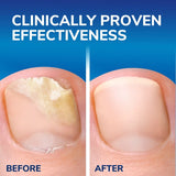 Scholl Fungal Nail 2 in 1 Treat & Shield 3.8mL - British product