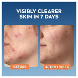 Nivea Derma Skin Clear Toner 200ml, imported from the UK