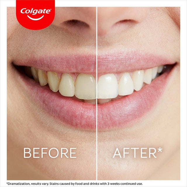 Colgate Max White Whiten At Home Teeth Whitening Pen - British product