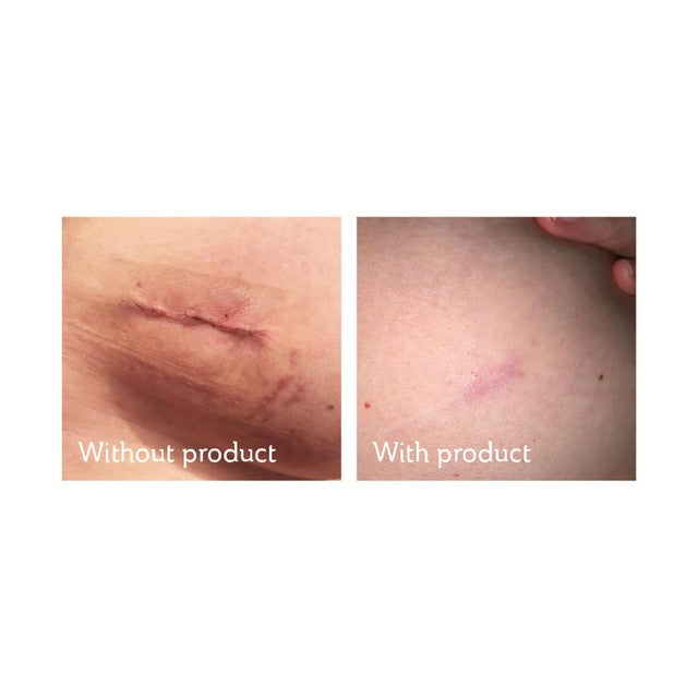 Science of Skin scar care cream 30ml (British brand)
