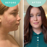 Skin Genius Best Cleanse Forever cleansing face wash, UK version