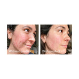 Science of Skin Rescue facial scar treatment 30ml (British brand)