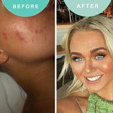 Skin Genius Soothe Soothing Moisturiser (British brand)