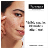 Neutrogena Ultra-Thin Blemish Patches 24 Patches, imported from the UK