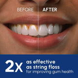 Waterpik Cordless Plus white water flosser (British brand)