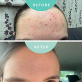 Skin Genius Best Cleanse Forever cleansing face wash, UK version