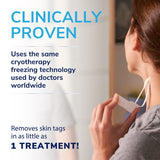 Scholl skin tag remover kit - British product