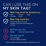 Scholl skin tag remover kit - British product