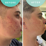 Skin Genius leave-on purifying gel - British product