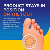 Scholl corn treatment kit (British brand)