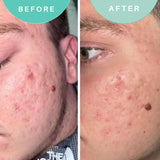 Skin Genius Soothe Soothing Moisturiser (British brand)