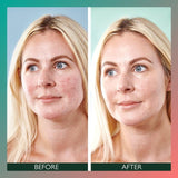 Sorted Skin Anti-Redness SPF50 day cream 30ml (British brand)