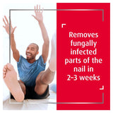Canespro Fungal Nail Treatment Set - British product
