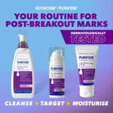 Cetaphil Purifide Post-Breakout Serum 30ml, imported from the UK