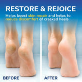 Scholl Cracked Heel Repair Cream 60ml (British brand)