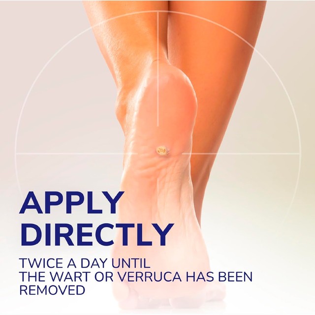 Scholl Verruca Remover Gel 10ml (British brand)
