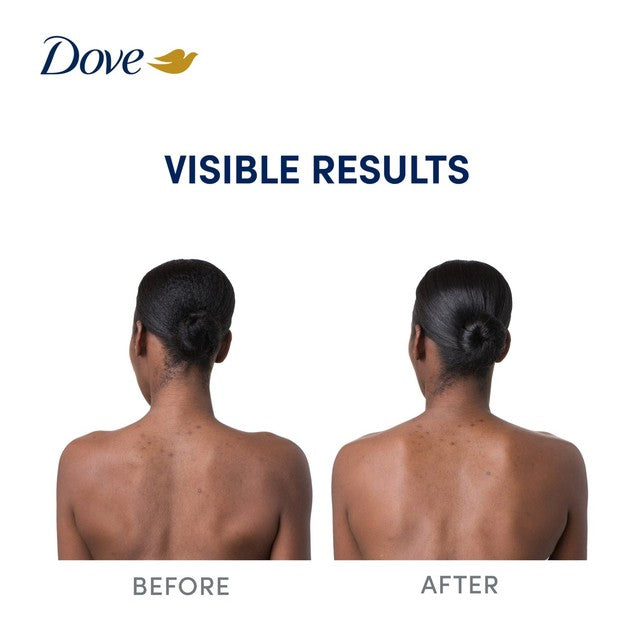 Dove Niacinamide Body Serum for even tone, UK version