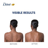 Dove Niacinamide Body Serum for even tone, UK version
