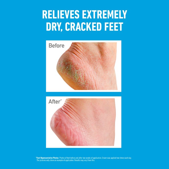 O'Keeffe's Healthy Feet foot cream 91g, imported from the UK
