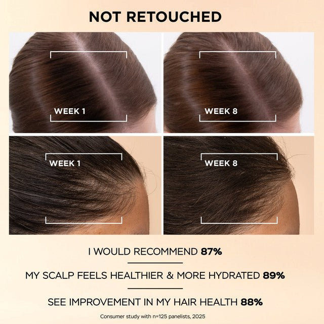 Pantene anti-hair loss scalp serum, imported from the UK