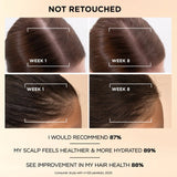 Pantene anti-hair loss scalp serum, imported from the UK