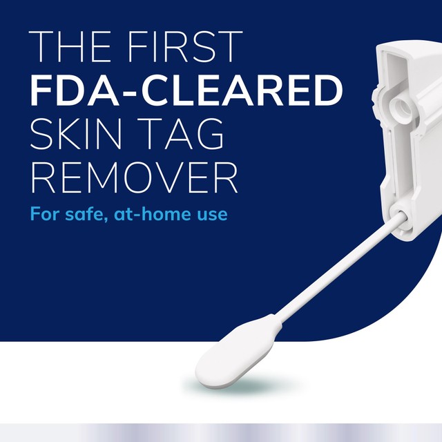 Scholl skin tag remover kit - British product