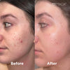 Gentle Cleansing Blemish-Preventing Facial Wash 150ml