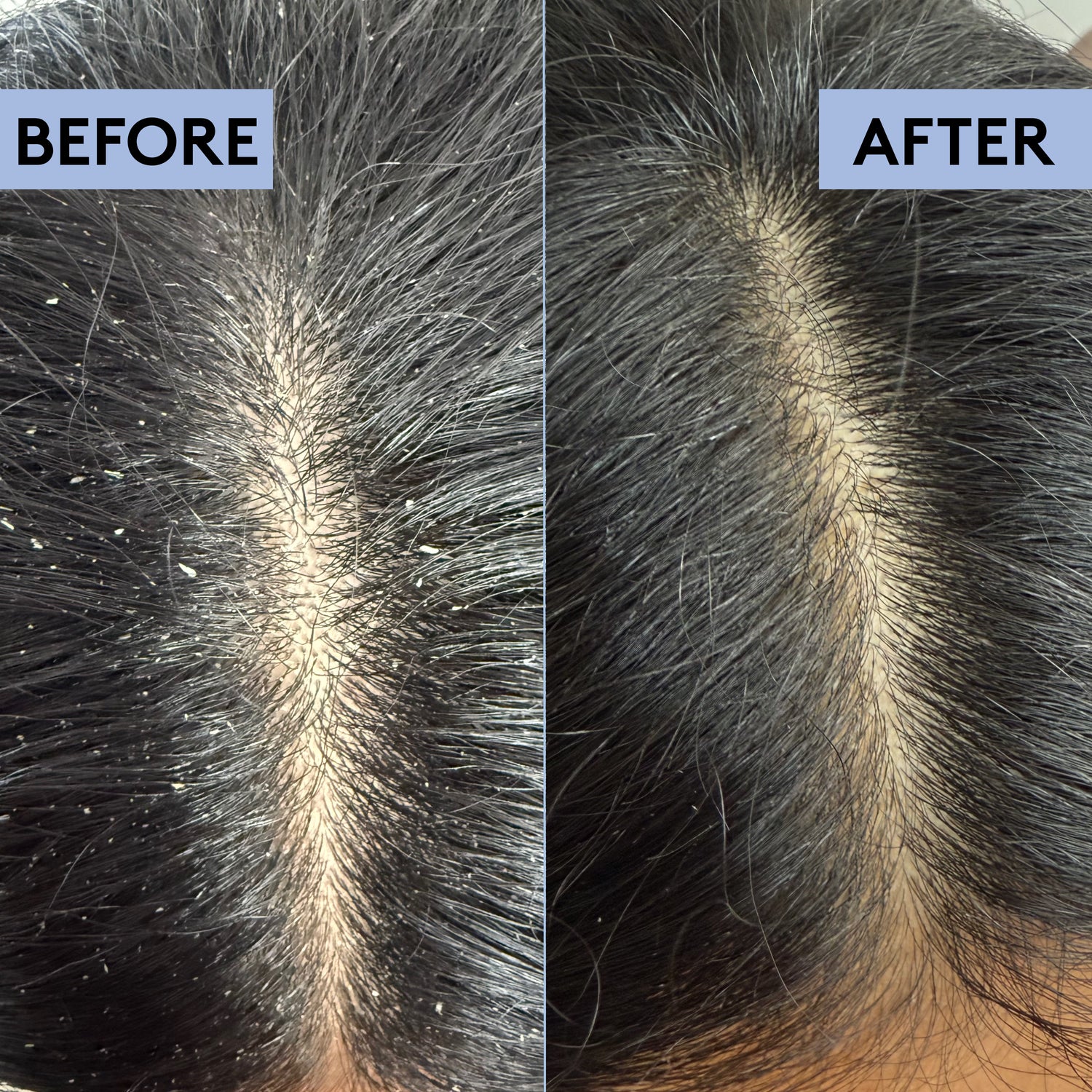 Scalp-Eaze Exfoliate & Clarify scalp scrub, UK version