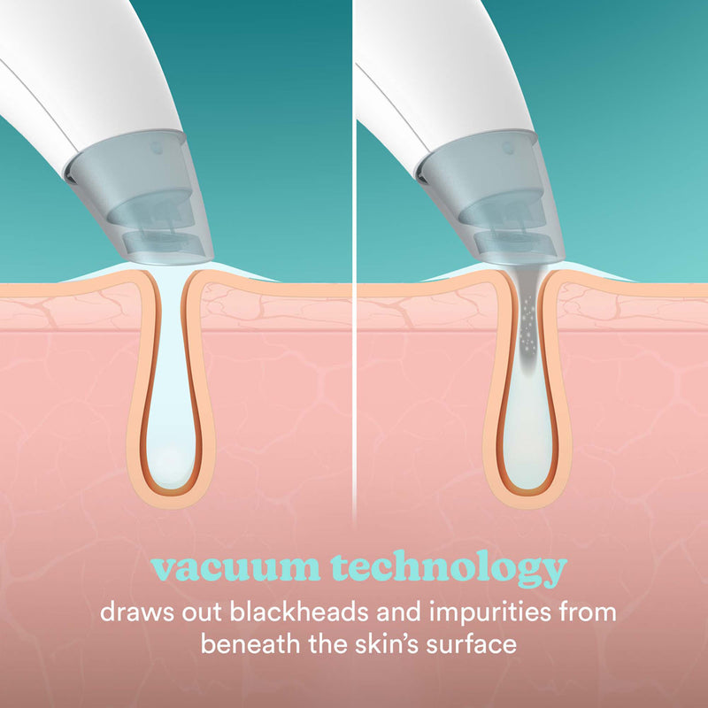 Homedics Refresh Hydradermabrasion cleanser (British brand)