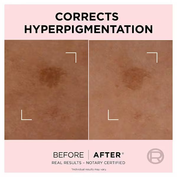 L'Oréal Paris Rapid Spot Corrector bottle, UK version